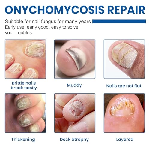 Extra Strength Toenail Fungus Treatment Patches - 60 Pcs Hydrogel