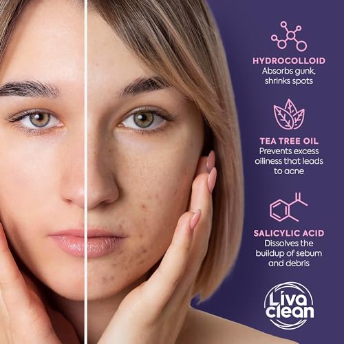 LivaClean Star Pimple Patches for Face w/Hydrocolloid, Salicylic Acid & Tea Tree, 240 Patches, Hydrocolloid Acne Patch, Cute Star Pimple Patch for Healing Stickers Zit Superstar