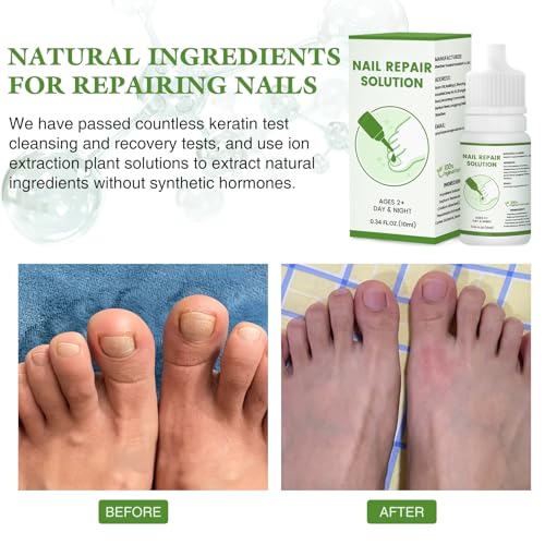 Nail Drops for Treating Toenail Odor and Fungal Infections, and Nail drops