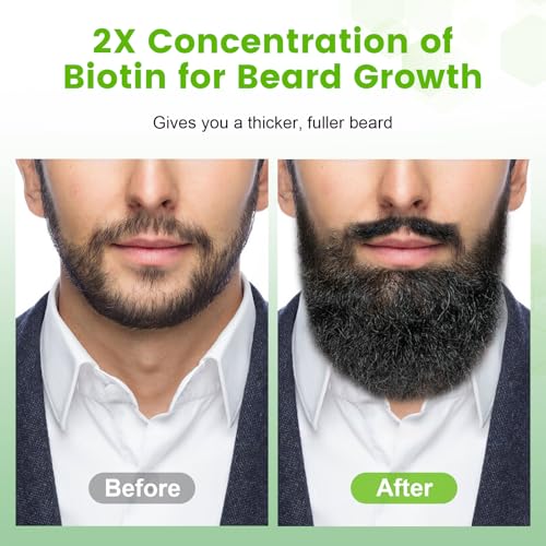 Beard Growth Balm-Beard Growth Kit