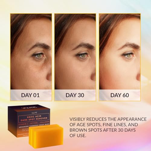 Kojic Acid Dark Spot Remover Soap with Vitamin C & Turmeric