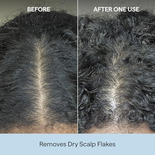 Briogeo Scalp Revival Charcoal + Coconut Oil Micro-Exfoliating Shampoo