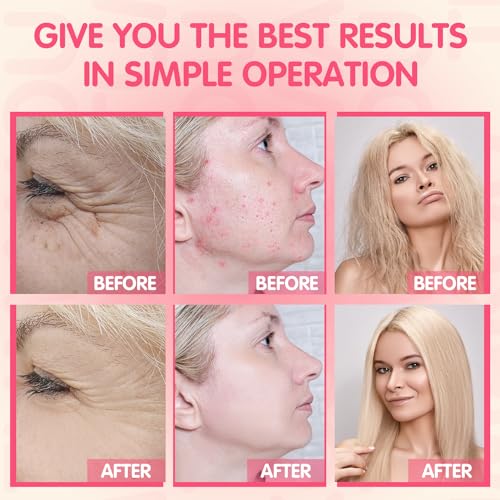 TUMAKOU High Frequency Facial Machine - 4 Tube Wand Device