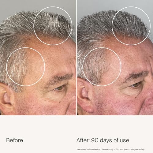Living Proof Scalp Care Density Serum