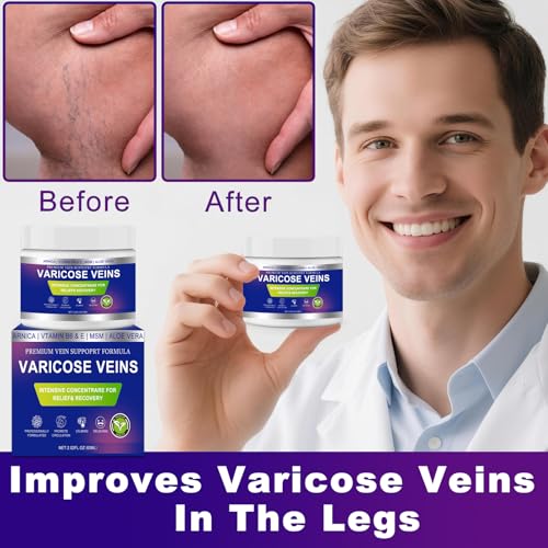 Varicose Veins Cream for Legs with Arnica & Aloe Vera