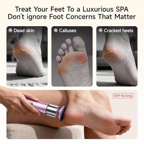 SUFU SUFU 2 in 1 Electric Foot Callus, USB Rechargeable Electric Foot File Grinder with Digital Display, Cordless Aluminum Pedicure Tools for Feet,Nail Care,Dead Skin (Pink)