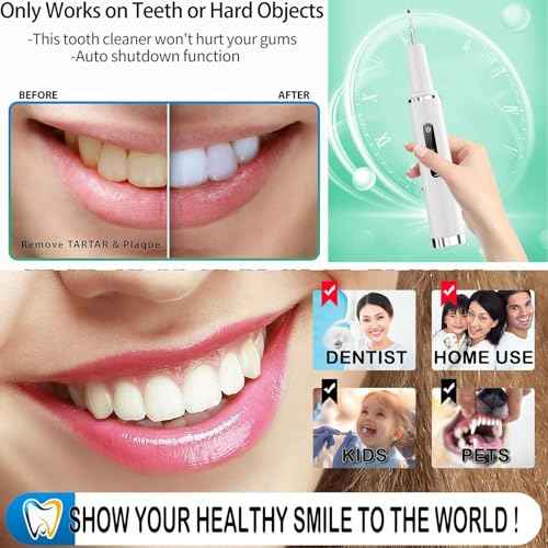 Professional Plaque Remover for Teeth, Teeth Cleaner Tool with Intelligent and Secure Sensor Technology, 4 Replaceable Heads 5 Modes, OLED Light & Oral Mirror, Rechargeable Teeth Cleaning Kit For Home