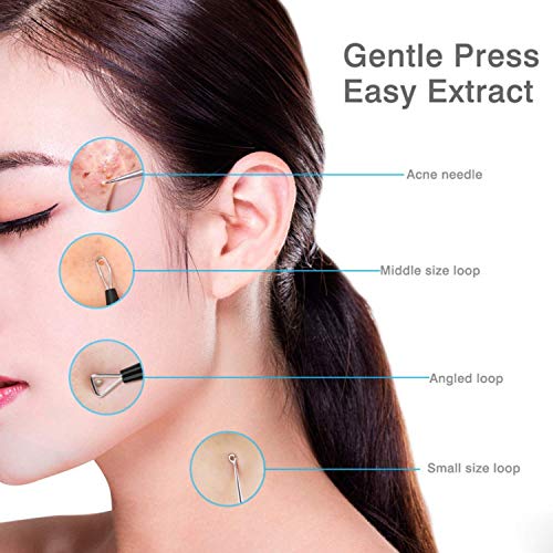 JPNK Blackhead Remover Tool Kit - 6 Pcs Acne Extractor Set