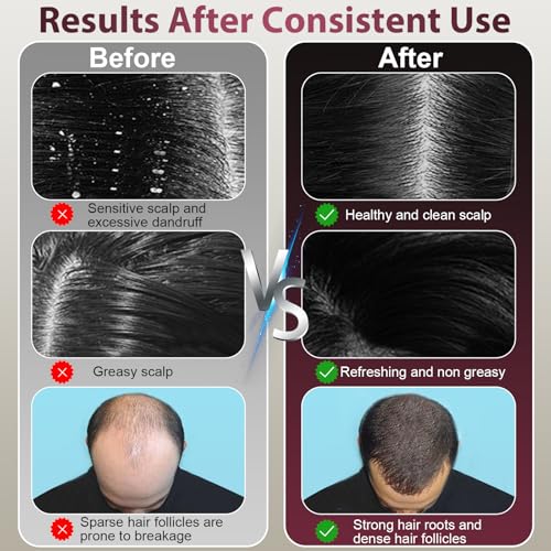 Electric Scalp Massager with Hair Oil Applicator & IPX7 Waterproof