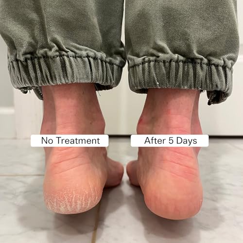 Pedestrian Project Cracked Heel Repair Balm - Shea Butter Foot Cream, 1 oz