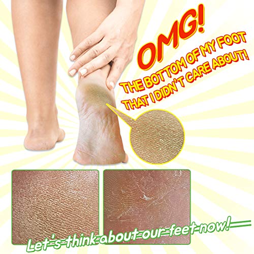Elizavecca Foot Peel Mask - Exfoliating Foot Pack for Soft Skin