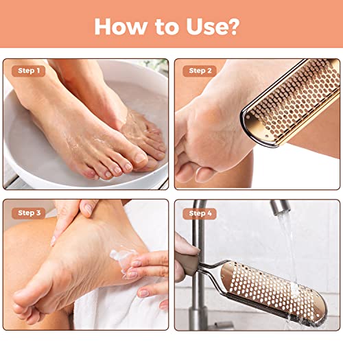 Foot File Foot Scrubber Pedicure - Callus Remover for Feet Easkep Professional Grater Rasp Foot Scraper Corns Callous Removers Cracked Dead Skin Remover for Dry and Wet Feet