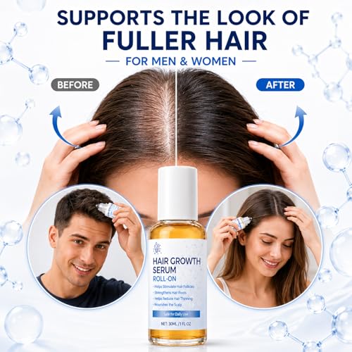 Nexkayee Hair Growth Serum Roll-On with Rosemary Oil - 30ml