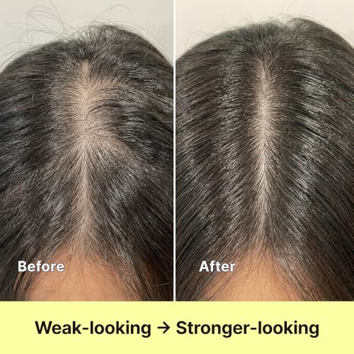 Black Grain Shampoo for Thinning Hair – Strengthening Formula, 16.9 fl oz