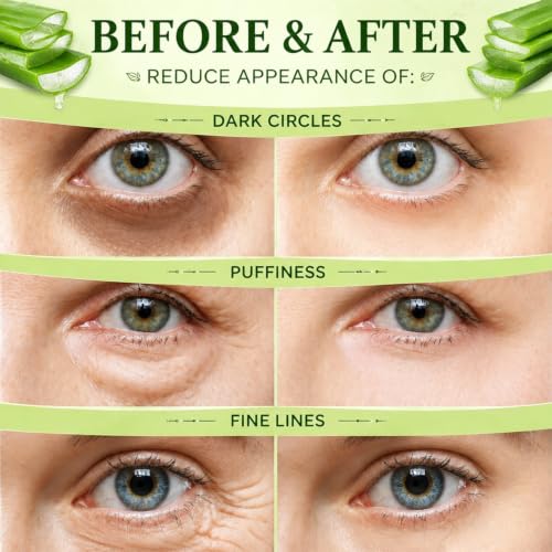 Eakroo Set A Aloe Vera Under Eye Patches - 60PCS for Dark Circles, Puffiness, Wrinkles