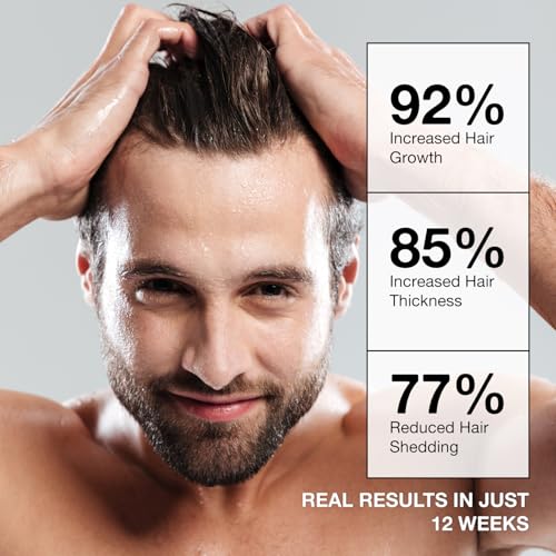 Beadlamey Root Activator Shampoo for Men - Hair Growth & Thinning Hair - 10.1 fl oz (Pack of 1)