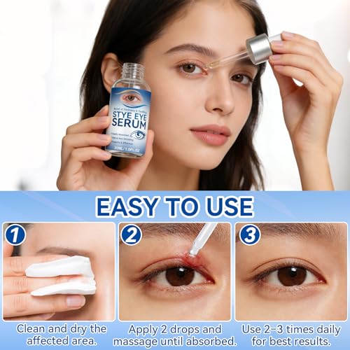 Stye Eye Treatment Serum 30ml - Natural Relief for Styes & Blepharitis
