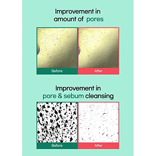 BRING GREEN Tea Tree Cica Pore Clay Pack | Vegan Deep Pore Cleansing Clay Mask, for Pore Purifying, Contains Cica & Tea tree for Soothing & Relieving Stressed Skin 4.23 oz.