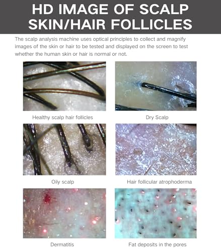 5-in-1 Skin Scalp Detector with 200X Magnification & Spectrum Analysis