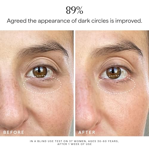 HERBIVORE Super Nova Eye Cream ? 5% THD Vitamin C & Caffeine, Reduces Dark Circles & Puffiness, Brightens Eyes, Plant-based, Vegan, Cruelty-free, 15mL / 0.5 oz