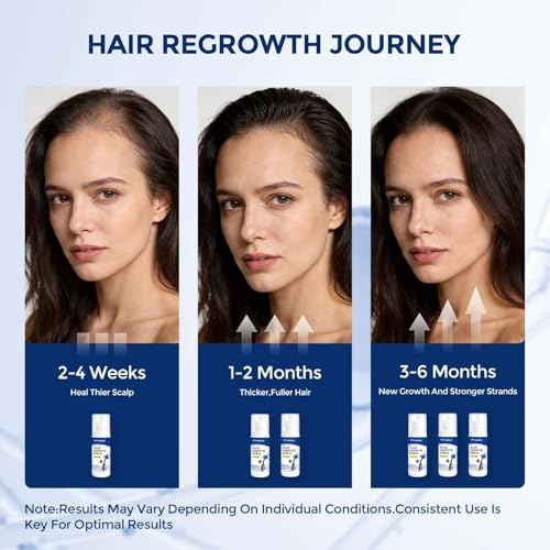 Hair Growth Spray with Biotin & Rosemary Oil for Women & Men