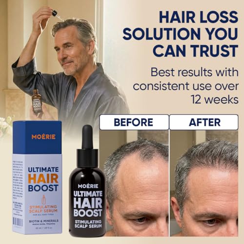 Moerie Hair Growth Serum - Natural Regrowth & Thickening, 50ml