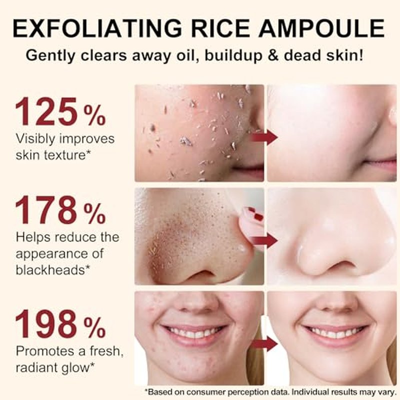 White Rice Peeling Glow Ampoule - Rice Exfoliator for Face & Body - Gentle Remove Dead Skin, Blackheads, Refine Pores & Provide Deep Hydration for All Skin Types, 100ml