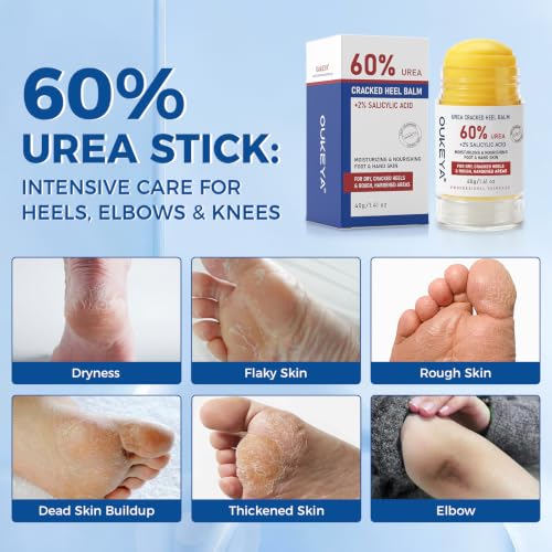 OUKEYA 1.41 oz Urea Stick 60% Moisturizer for Dry, Cracked Skin, Pack of 1