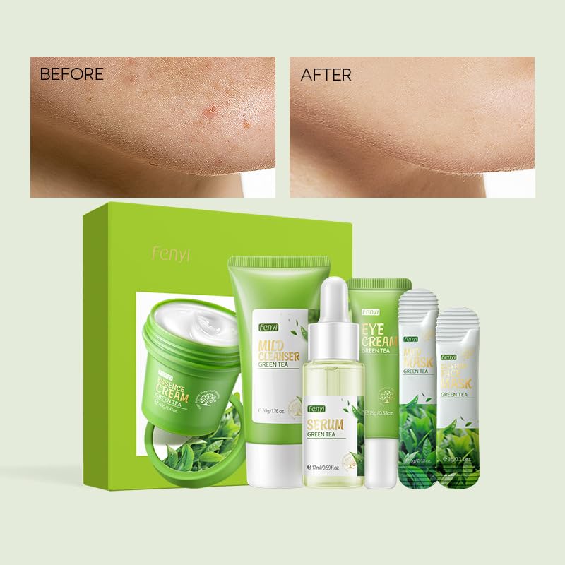 Green Tea Skincare Set, 19-In-1 Skincare Gift Set, With Natural Extracts,Cleanser,Face Serum, Face Cream, Eye Cream, Facial Mask And Mud Mask,Moisturizing Skincare Set For Teen Girls