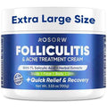 Folliculitis & Acne Treatment Cream ? Salicylic Acid & Herbal Extracts for Scalp, Face, Body & Back ? Soothes Irritated Skin, Redness & Itch Relief ? 100g (Pack of 1)