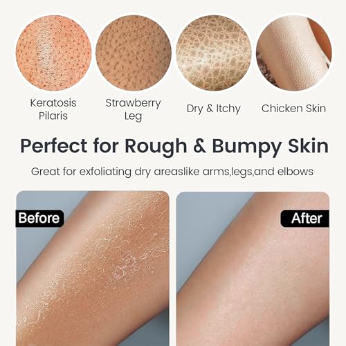 Yiclick Exfoliating Gloves 4-Pack – Deep Clean Dead Skin Removal
