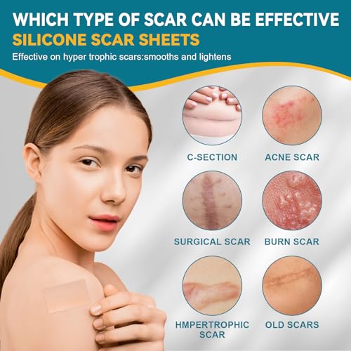 Silicone Scar Tape for Surgical Marks Face Stick Keloid Cover C-Section Strips Wrinkle Cream Lip Sleeping Gel Sheet Tummy Patch Hydrocolloid Roll Soft (3 Pack, 1.6"X 60")