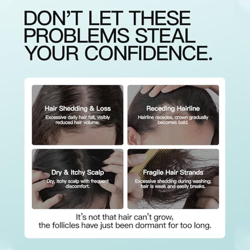 5% Minoxidil Hair Growth Cream for Men & Women - Extra Strength