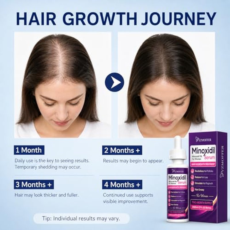 5% Minoxidil Hair Regrowth Treatment for Women - 2-Month Supply