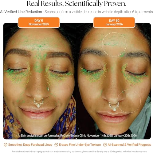 ReGlow Micro-Infusion Serum for Face - Radiance & Firmer Skin, 6 Treatments, 24ml