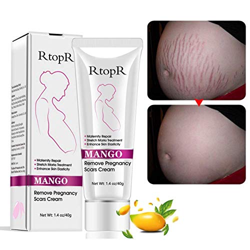 Mango Stretch Mark & Scar Removal Cream 40g