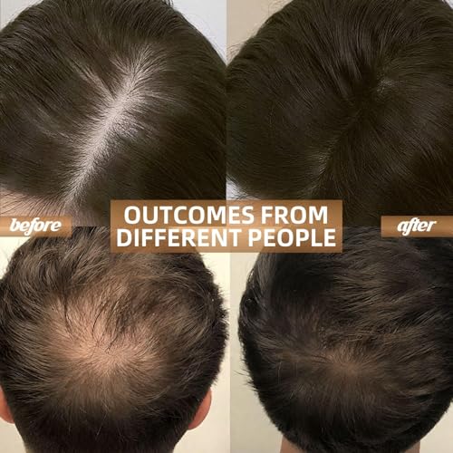 Red Light Therapy Laser Cap for Hair Growth & Loss