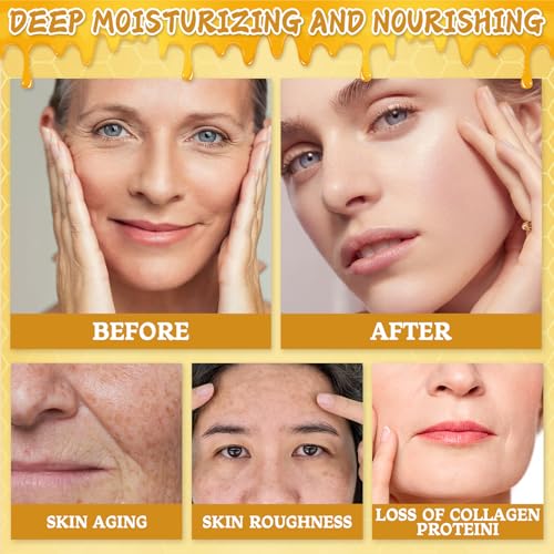 Bee Venom Skin Cream, New Upgrade 2pcs 60g Multipurpose Bee Venom Skin Treatment Cream for Repair, Moisturize and Lift