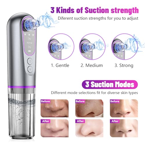 Blackhead Remover Vacuum with 3 Suction Levels & 5 Heads