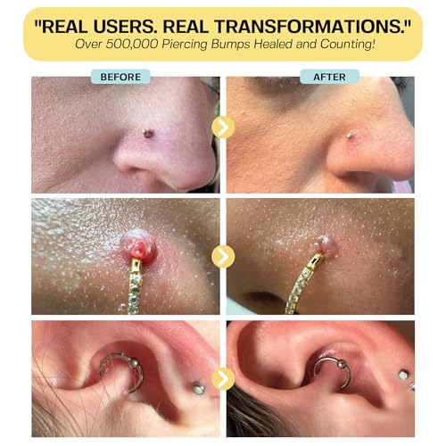 BASE LABORATORIES Piercing Bump Solution - Keloid Removal Aftercare Oil