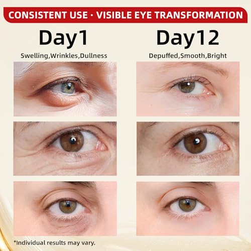 Caffeine & Retinol Under Eye Serum ? Dermatologist-Tested, Fast Absorbing, Correction for Puffy Eye Bags Fine Lines Dark Circles Wrinkles While Providing Moisturizing Care 0.7 Oz