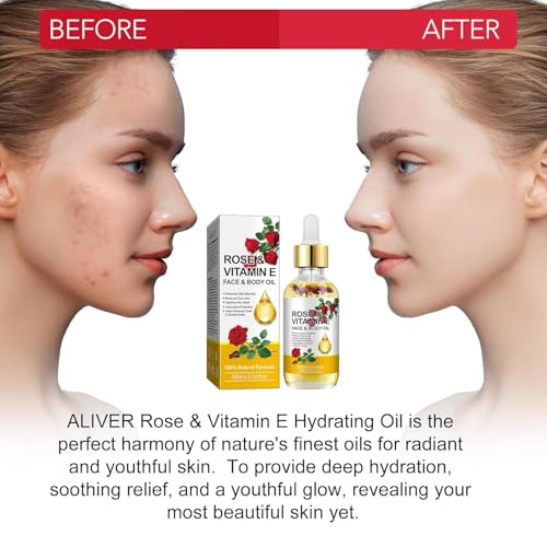 Vitamin E Face Oil,Rose Vitamin E Oil with Gua Sha Massage Tools for Face & Body,Organic Rose Oil for Moisturizing and Hydrating-2.02 fl.oz