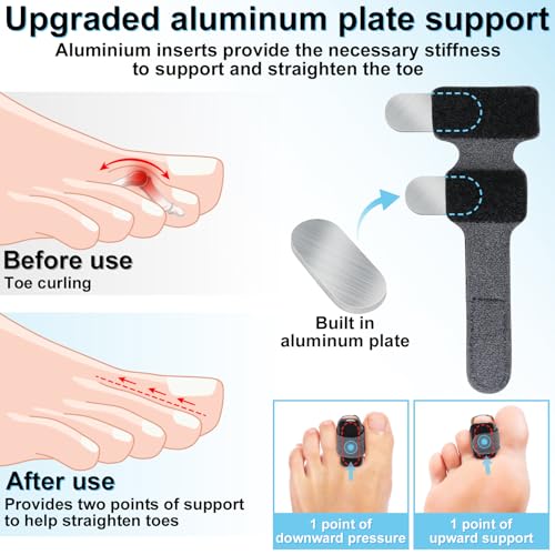 Hammer Toe Straightener with Aluminum Plate - Adjustable Toe Corrector