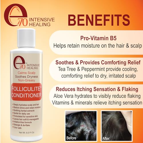 Folliculitis Treatment Conditioner with Salicylic Acid & Tea Tree Oil - Anti-Itch Scalp Care, 8 Fl Oz