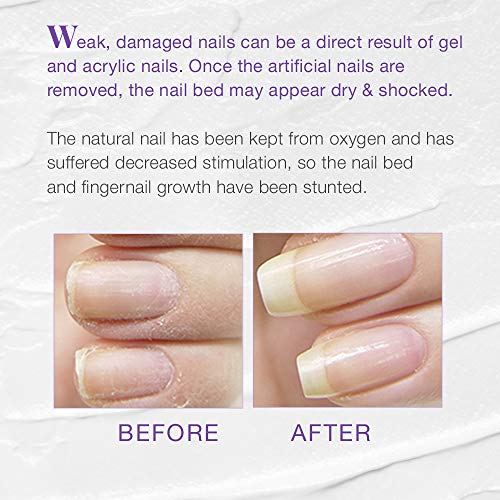 Nail Tek Xtra 4, Nail Strengthener for Weak and Damaged Nails, 0.5 oz, 1-Pack