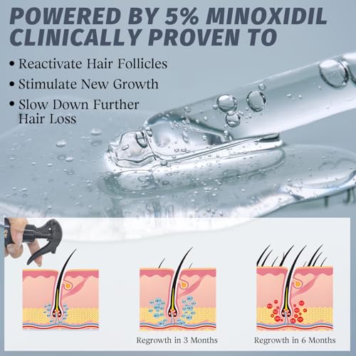 5% Minoxidil Spray for Hair Growth - Men & Women