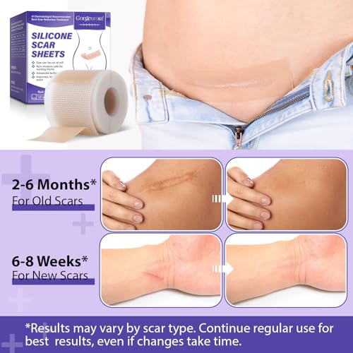 Silicone Scar Sheets, Silicone Scar Tape (1.6¡± x 60¡± Roll, 1.5M) ? Reusable Silicone Scar Sheets for Surgical Scars, C-Section, Keloids, Burns, Acne, and Keloid Bump Removal