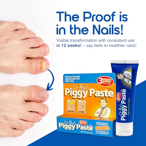 Dr. Paul's Piggy Paste Gel 2-Pack: Fast Acting Solution for Thick, Brittle, Yellow Nails, Restores Clear, Healthy Toenails & Fingernails Easy, Mess-Free Application Doctor Recommended Formula