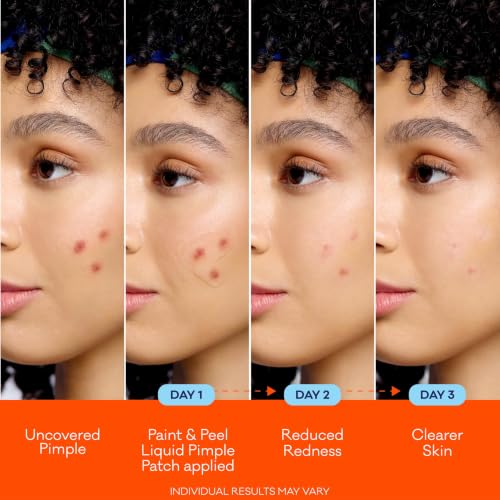 Bioré Paint & Peel Liquid Pimple Patch - Salicylic Acid Acne Treatment