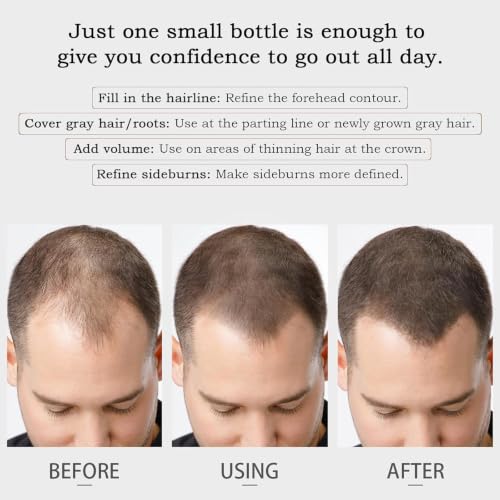 Densiq Pro Hair Density Filler Powder - Waterproof Hairline